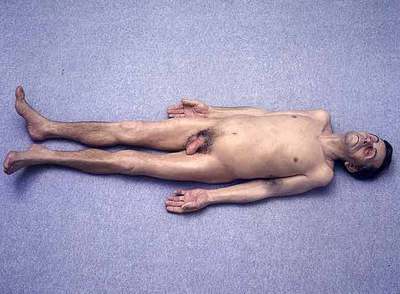 'Dead Dad' (1996-1997), escultura de Ron Mueck.