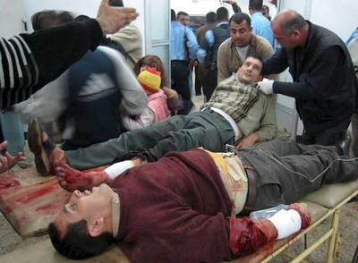 Varios iraquíes heridos, ayer en el hospital local de Kirkuk (norte de Irak).