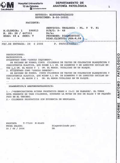 Copia de los resultados de la biopsia de próstata con el diagnóstico de cáncer que la esposa de Juan H. M. y un médico encontraron archivada por error.