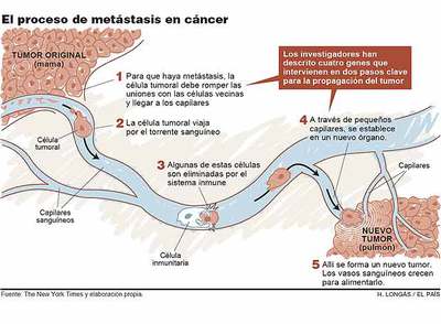 El científico Joan Massagué descubre la clave de la metástasis de cáncer al pulmón