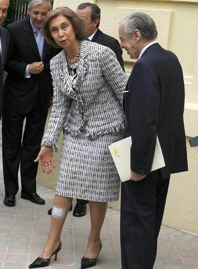 La Reina muestra su lesión, junto a José Ángel Sánchez Asiaín.