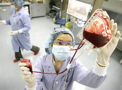 Cordones umbilicales a la fuga