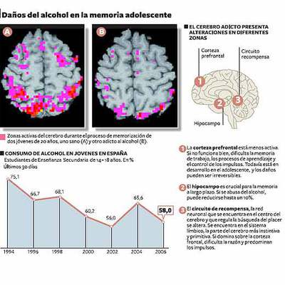 Alcohólicos compulsivos de 20 años