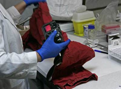 UN PANTALÓN MANCHADO DE SANGRE