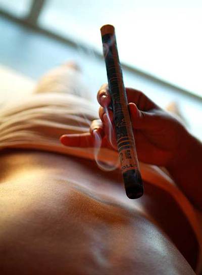 Tratamiento de aplicación de calor con  moxa,  artemisa ardiente, en The Chi Spa, un centro de  wellness  en Madrid.