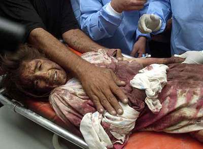 La imagen de una niña iraquí herida en bombardeos estadounidenses en Faluya, tomada por Bilal Hussein.