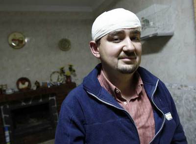 José Manuel Borrachero, uno de los heridos.