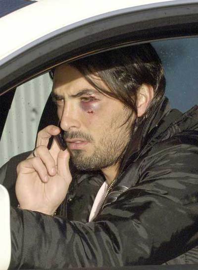 Aouate, tras la agresión.