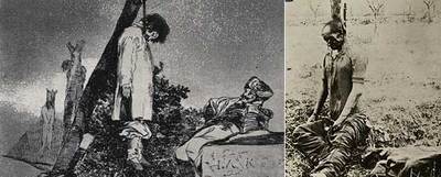 Estampa de  Los desastres,  de Goya y herido de la I Guerra Mundial. Archivo Clínica Bier (Berlín).