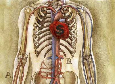 El dinero como mercancía
