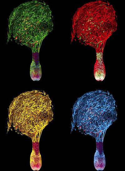 Pelos vistos al microscopio electrónico.