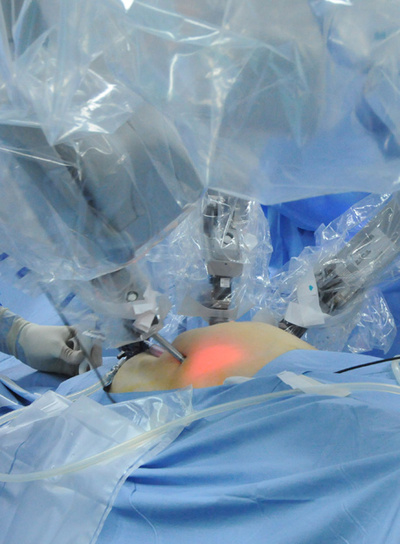 Operación con el robot Da Vinci.