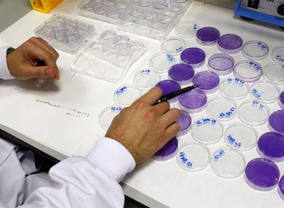 Los estudios pagados con dinero privado raramente son para prevenir enfermedades.