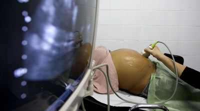 Una médica realiza una ecografía a una embarazada en un centro de salud de Barcelona.