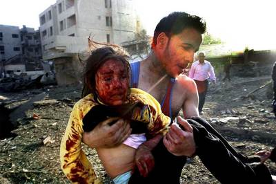 Un hombre ayuda a una niña herida en el atentado contra el hotel Hamra, en Bagdad.