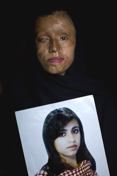Uno de los 10 retratos de mujeres con el rostro desfigurado realizados por Emilio Morenatti para el proyecto  Violencia de género en Pakistán  (2008), primer premio Fotopres.