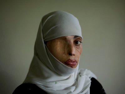 FOTOGALERIA: Víctimas cotidianas