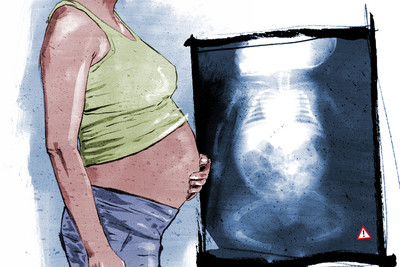 Una paga para el que vive por error