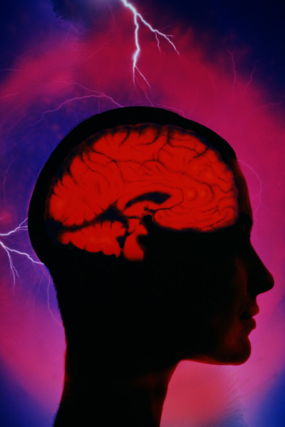 No falla la mente, sino el cerebro