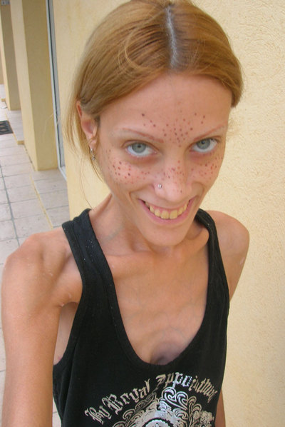 Isabelle Caro en una imagen de su  blog.  