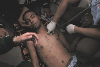 Un herido en una de las manifestaciones celebradas ayer en El Cairo es atendido en plena calle.