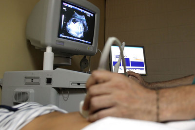 Un médico realiza una ecografía a una mujer embarazada.