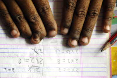 Las manos de Shanta, deformadas por el trabajo.