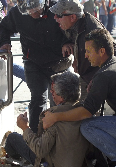 Un hombre herido durante los enfrentamientos entre manifestantes y policías a las puertas del Parlamento.