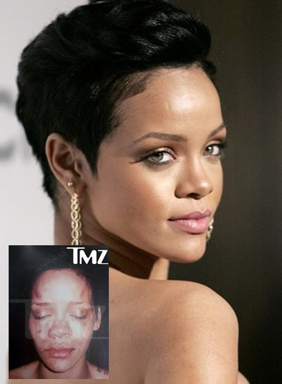 Rihanna cumple 21 años el 20 de febrero en medio de la polémica. Tras haberse hecho público el maltrato por parte de su novio, Chris Brown, ahora se ha filtrado una foto que la muestra con golpes y magulladuras. El padre de Rihanna, Ronald Fenty, se ha mostrado desilusionado con la policía. 