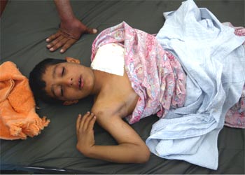 Un niño se recupera de sus heridas en el hospital de Faluga.