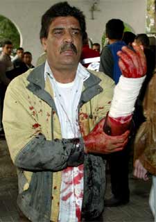 Un hombre enseña, en el hospital de Gaza, las heridas sufridas en la incursión.