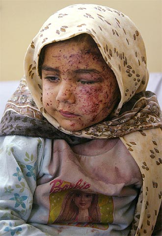 Una niña iraquí, ingresada en el principal hospital de Nayaf, muestra las heridas sufridas ayer en el atentado.