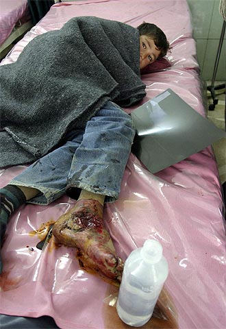 Un niño iraquí se recupera en el hospital de Al Yarmouk de Bagdad tras resultar herido en un ataque contra un convoy.