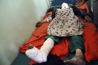 Una mujer herida, víctima de una explosión, yace en un hospital de la provincia afgana de Herat.