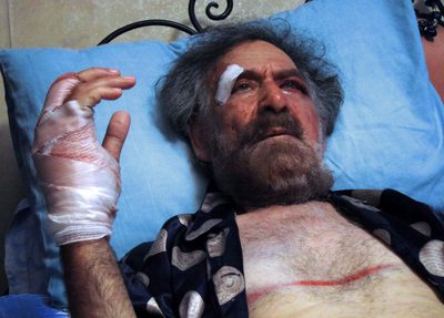 El caricaturista sirio opositor Ali Ferzat tras la agresión, en su cama de hospital, en Damasco