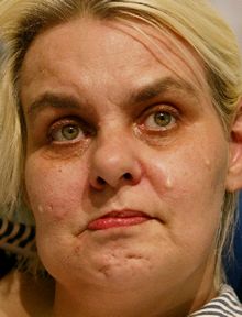 Fallece la enferma británica a la que Estrasburgo negó el derecho al suicidio asistido