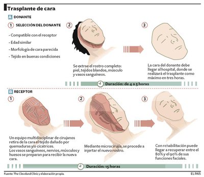 Segundo trasplante de cara en España, primera aparición pública