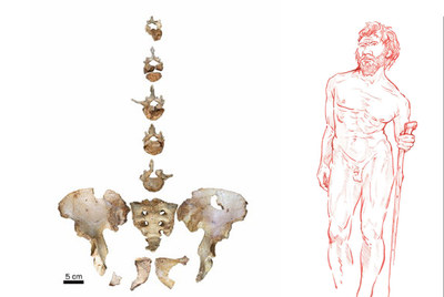 Pelvis y vértebras del anciano de Atapuerca y una reconstrucción de su aspecto.